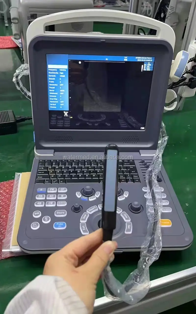 2d /3d/4d ultrassom médico máquina