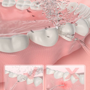 USB Portable 220ML Oral Irrigator Dental Water Jet Tool com 1 bocal para limpeza da boca e agentes orais para o dia dos namorados - Product Image 4