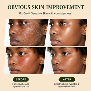 Crema Hidratante Calmante con Ácido Hialurónico y Pantenol, Repara la Piel África Seca, Sensible y Dañada por Rayos UV, Marca Privada - Product Image 5