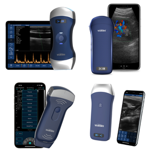 L'injection intra-articulaire guidée par ultrasons contribue à garantir une injection intra-articulaire et minimise les dommages aux <span class=keywords><strong>tissus</strong></span> <span class=keywords><strong>mous</strong></span> para-articulaires. - Product Image 1