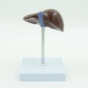 PVC病的肝臓モデルが一般的な肝および胆嚢障害を視覚化 - Product Image 2