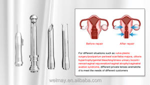Máquina Láser <span class=keywords><strong>de</strong></span> CO2 Profesional <span class=keywords><strong>de</strong></span> Fábrica para Eliminación <span class=keywords><strong>de</strong></span> Estrías, Láser Fraccional para Eliminación <span class=keywords><strong>de</strong></span> Tatuajes, Láser Fraccional <span class=keywords><strong>de</strong></span> CO2 - Product Image 5