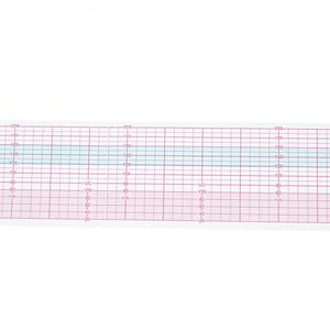 Carta per Monitoraggio Fetale 57x20m, Rotolo di Carta Termica di Grado Medico 57mm di Larghezza (Bianco/Rosa/Azzurro) - Product Image 5