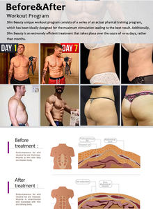 تحسين العضلات وتحفيز حرق الدهون التحكم في المسافة نحت تزن - Product Image 5