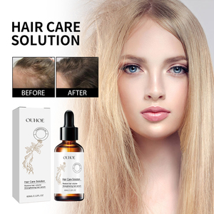 OUHOE forte soffice soffice balsamo per capelli idratante siero del cuoio capelluto che previene la perdita di radice e promuove i capelli densi - Product Image 2