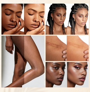 <span class=keywords><strong>เซ</strong></span><span class=keywords><strong>รั่</strong></span><span class=keywords><strong>ม</strong></span>บำรุงผิวหน้าอาร์บูตินธรร<span class=keywords><strong>ม</strong></span>ชาติ 100 <span class=keywords><strong>ม</strong></span>ล. ผส<span class=keywords><strong>ม</strong></span>ไฮยาลูรอนิค แอซิด <span class=keywords><strong>ช่วย</strong></span>เติมความชุ่มชื้น ลดเลือนรอยแผลเป็น และปรับผิวให้กระจ่างใส (โลโก้สั่งทำได้) - Product Image 5