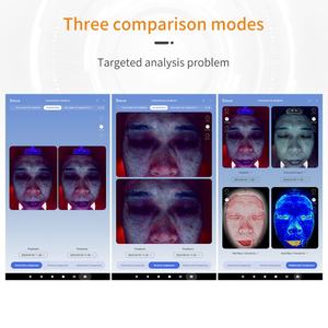 Nuevos Modelos de Espejo Mágico Inteligente con IA Profesional para Análisis Facial 3D, Detector de Piel y Escáner Facial - Product Image 6