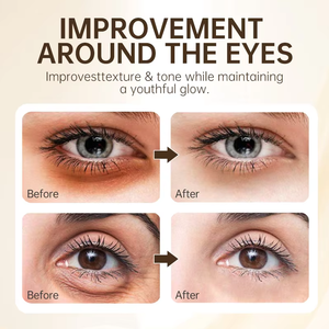 Mejor Crema para Ojos con Cúrcuma y Vitamina C, Vegana, Blanqueadora, Reparadora, Reafirmante, Antiarrugas, para Ojeras e Hinchazón, Venta al por Mayor - Product Image 2