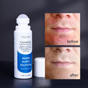 Solution après-<span class=keywords><strong>rasage</strong></span> de marque privée soulage les poils incarnés Solution anti-bosse pour rasoir Traitement contre les bosses pour hommes Après-<span class=keywords><strong>rasage</strong></span> - Product Image 3