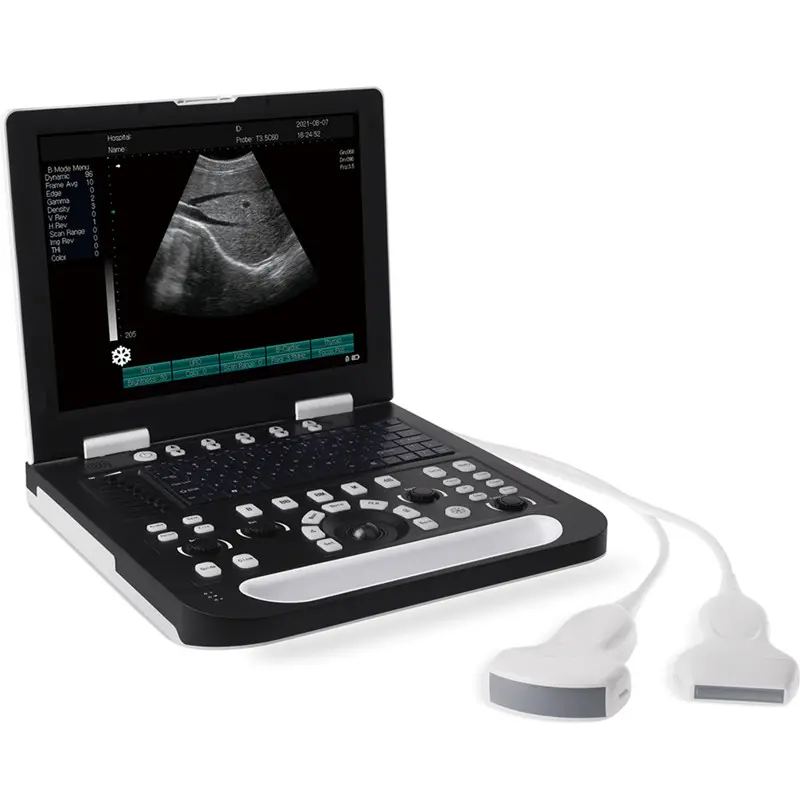 Sonoscape portátil 2D 3D 4D Color Doppler máquina de escáner de ultrasonido para veterinaria y humanos