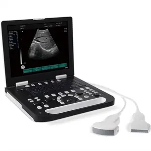 Sonos cape tragbarer Laptop 2D 3D 4D Farbdoppler-Ultraschalls canner für Veterinär und Mensch