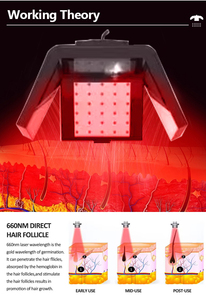 Free Tax Bioelectric <b>Vibration</b> Hair Care Machine Improving Hair Growth Environment and Preventing Hair Loss - Product Image 3