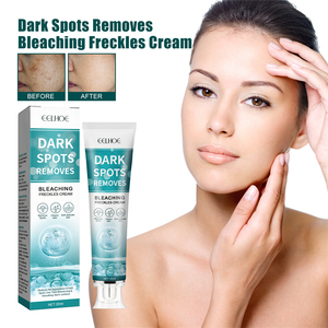 EELHOE sbiancante lentiggini <span class=keywords><strong>crema</strong></span> per la rimozione delle macchie scure Melasma scottature da sole macchie di gravidanza che riducono la pelle idratante <span class=keywords><strong>crema</strong></span> riparatrice - Product Image 4