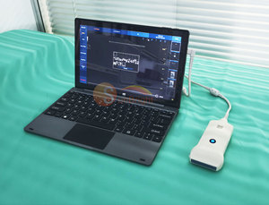 USB Portátil Cor <span class=keywords><strong>Doppler</strong></span> Ultrassom Sonda Veterinária Mini Digital Cor Ultrassom Linear Probe - Product Image 3
