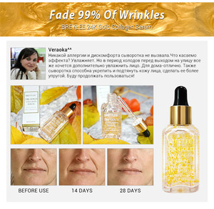 Suero Antienvejecimiento BREYLEE con Ácido Hialurónico, Rosa Nutritiva, Vitamina <span class=keywords><strong>C</strong></span> Blanqueadora, Esencia Reparadora <span class=keywords><strong>Facial</strong></span> con Oro de 24k - Product Image 2