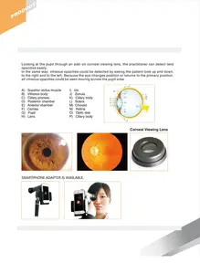 OJO Oftalmológico Optical Oftalmología Optometría Pantoscópica Oftalmoscopio Fábrica de China, Laboratorio Médico de Hospital