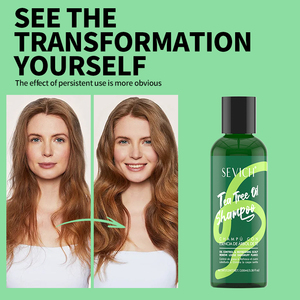 Juego personalizado de cuidado del cabello con aceite de árbol de té, caja de regalo, crecimiento del cabello de <span class=keywords><strong>barba</strong></span>, suavizante, champú de aceite de árbol de té Natural, juego de cuidado del cabello de Romero - Product Image 4