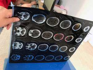 Stampante per pellicole a raggi <span class=keywords><strong>X</strong></span> digitale di vendita calda - Product Image 5