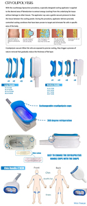 <span class=keywords><strong>Appareil</strong></span> professionnel de <span class=keywords><strong>cryolipolyse</strong></span> 360° pour la réduction complète de la graisse corporelle, destiné aux salons - Product Image 5