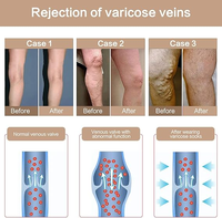 Bas de contention médicaux personnalisés en tricot DVT sans bout, hauteur cuisse, anti-embolie, pour varices, 15-20 mmHg, pour femmes