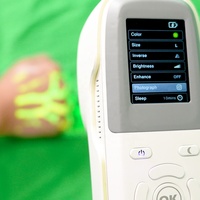 Détecteur de veine faciale pour l'utilisation de beauté Machine de visualisation de veine médicale Détecteur de veine de bébé