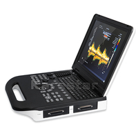 Karestar Échographe numérique portable le moins cher, échographe portable à prix réduit, ordinateur portable, échographe vétérinaire 3D