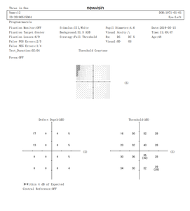 BIO-1000 Tiongkok terkenal penganalisa bidang <span class=keywords><strong>Visual</strong></span> otomatis instrumen Perimeter statis pengujian bidang pandangan - Product Image 6
