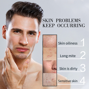 Mencare OEM Người Đàn Ông Của Kiểm Soát Dầu Da Sữa Rửa Mặt Làm Mới Bọt Rửa Mặt Với Loại Bỏ Mite Bởi Người Đàn Ông Của Chăm Sóc - Product Image 4