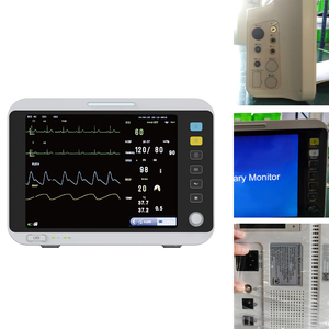 Monitor de presión arterial veterinario multiparámetro portátil para animales de compañía, equipo de veterinario de - Product Image 3