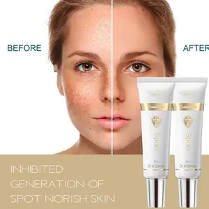 Best Skin Whitening Day and Night Anti Freckles Removal Remove Freckle Dark Spots Face Cream For Face Pigmentation Treatment