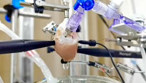 อาร์เรย์ปากกาไมโครอิเล็กโทรดความหนาแน่นสูงสำหรับการบันทึกและการทำแผนที่การนำไฟฟ้าของหัวใจแผนที่คลื่นไฟฟ้า ECG - Product Image 6