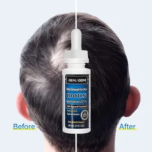 Fast Hair growth product Hair Growth Serum Tonic 60ml Kooplex 5% Hair Growth Oil