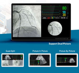 एंटी बैक्टीरियल 4K अल्ट्रा एचडी सर्जिकल मॉनिटर, ऑपरेटिंग रूम के साथ एंटीबैक्टीरियल 4K अल्ट्रा एचडी सर्जिकल मॉनिटर 3840 लिए 2160 - Product Image 5