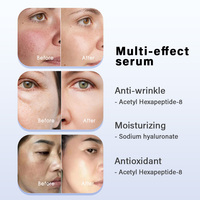 Sérum visage anti-âge à l'acide hyaluronique et à la niacinamide, marque privée OEM ODM, pour éclaircir la peau et éliminer les taches brunes