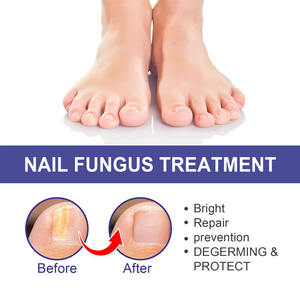 <span class=keywords><strong>Meilleur</strong></span> <span class=keywords><strong>traitement</strong></span> antiseptique des champignons des orteils, <span class=keywords><strong>traitement</strong></span> des champignons des doigts et des orteils, OUHOE - Product Image 2
