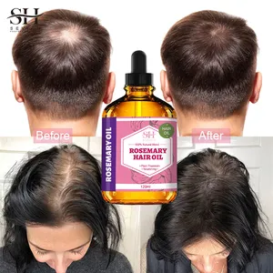 All'ingrosso 100% pura natura olio di rosmarino rosa organico per capelli veloce efficace olio di crescita