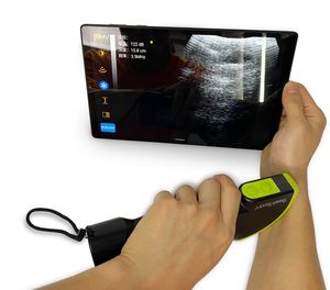 <span class=keywords><strong>Ultrasound</strong></span> <span class=keywords><strong>S4</strong></span> Tanpa Kabel, Mesin <span class=keywords><strong>Ultrasound</strong></span> <span class=keywords><strong>Probe</strong></span> Babi Domba Kambing Kehamilan Ecografo Tanpa Kabel WIFI - Product Image 2