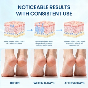 Kaki retak lengket pengelupasan tangan melembapkan & Kaki penghilang kulit mati perawatan kaki tumit retak perbaikan 60% krim Urea stik - Product Image 2