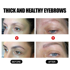 Sérum de croissance des sourcils EELHOE, à base d'herbes naturelles, pour des sourcils plus épais et plus fournis, traitement à l'huile essentielle, soin nourrissant et revitalisant pour tous. - Product Image 4