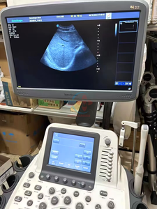 Mesin <span class=keywords><strong>Ultrasound</strong></span> Doppler Bekas Sonoscape M22 Instrumen <span class=keywords><strong>Ultrasound</strong></span> Medis Sistem <span class=keywords><strong>Ultrasound</strong></span> Harga - Product Image 4