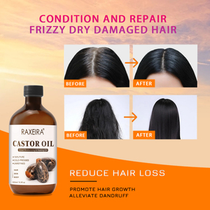 Commercio all'ingrosso olio per la crescita dei capelli naturale per la cura dei capelli rosmarino olio di ricino biologico spremuto a freddo esano alla rinfusa Jamaican olio di ricino nero - Product Image 4
