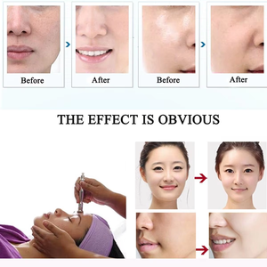 Bán buôn kim cương tip Peel Microdermabrasion Máy Nhà chăm sóc cá nhân làm sạch da mặt công cụ làm đẹp phong cách hiện đại - Product Image 2