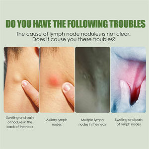 South Moon, 1 pieza, rodillo de limpieza linfática, <span class=keywords><strong>ganglios</strong></span> linfáticos, hinchazón, alivio del dolor, rodillo de masaje corporal linfático, herramienta - Product Image 2