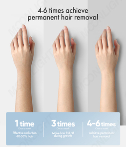 Cigno nero tripla lunghezza d'onda Pro Laser di depilazione 4 onde di raffreddamento analisi della pelle - Product Image 4