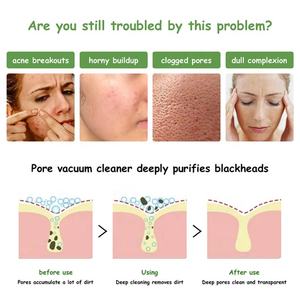 Mascarilla Facial Sólida de Arcilla de Té Verde, Cuidado Facial Natural y Orgánico con Logotipo Personalizado OEM - Product Image 2