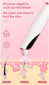Aspiratore per Punti Neri USB/Batteria, Pulitore Pori, Dispositivo per Pulizia Profonda del Viso, Portatile per Hotel, Apparecchio per Cura Personale - Product Image 3