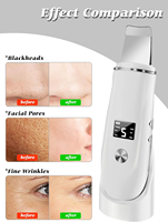 Appareil de nettoyage de la peau à micro-courant 4 en 1, spatule pour le visage, extracteur de points noirs, extracteur de pores, outil de soin de la peau pour un nettoyage en profondeur du visage