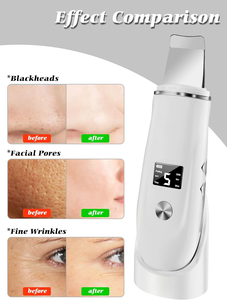 Appareil de nettoyage de la peau à micro-courant <span class=keywords><strong>4</strong></span> en 1, spatule pour le visage, extracteur de points noirs, extracteur de pores, outil de soin de la peau pour un nettoyage en profondeur du visage - Product Image 5