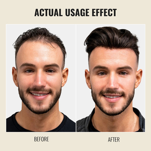 Productos para la Caída del Cabello de Marca Privada, Tratamiento para el Crecimiento del Cabello con Biotina, Champú Anticaída para Hombres - Product Image 6