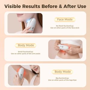 <span class=keywords><strong>Appareil</strong></span> de massage corporel sans fil pour le remodelage corporel, la combustion des graisses par pression négative et la lutte contre la cellulite, personnalisable - Product Image 3